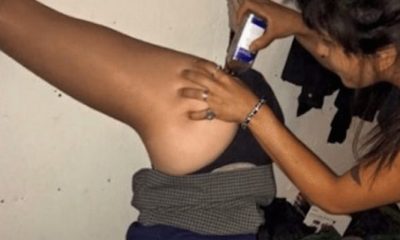 Butt Chugging Cough Syrup: A Disturbing New Trend Among Teens - GREEN RUSH DAILY