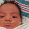 Say Hello to 2 Month Old Amylea, The World's Youngest Medical Cannabis Patient Ever - GREEN RUSH DAILY