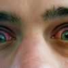 Why Does Marijuana Makes Your Eyes Red?