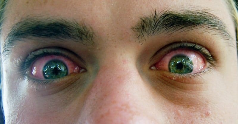 Глаза под марихуаной tor browser ipa скачать hidra