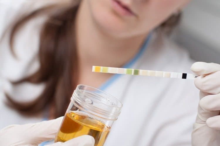 How Long Does Weed Stay In Your System For Urine tests?