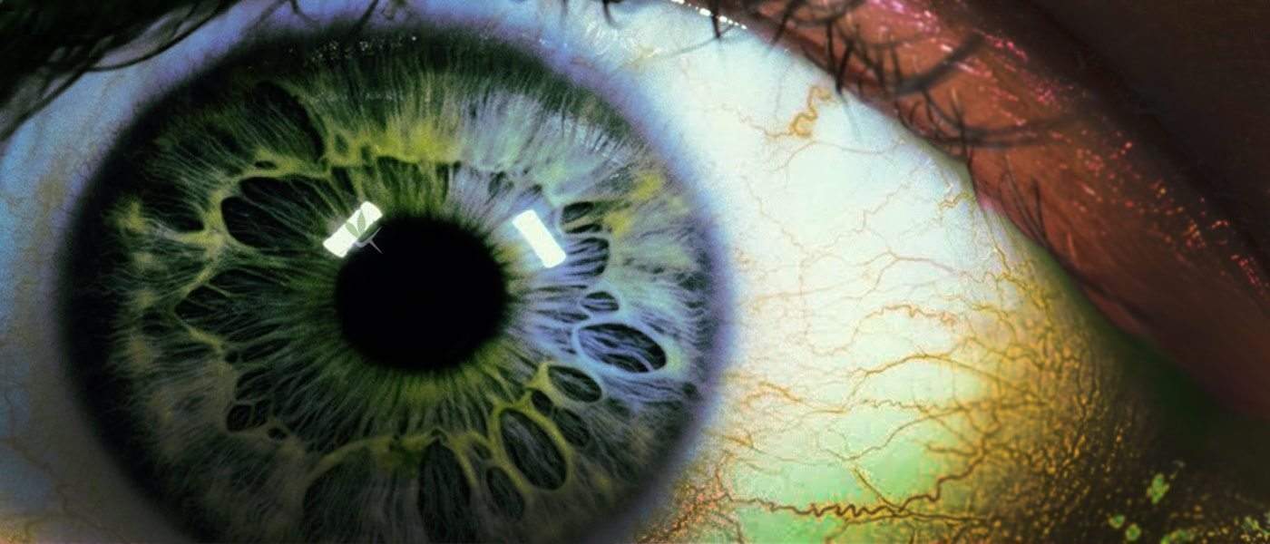 How Cannabis Helps With Glaucoma