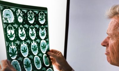 Multiple Sclerosis Symptoms Are Relieved By Cannabis: Here’s How