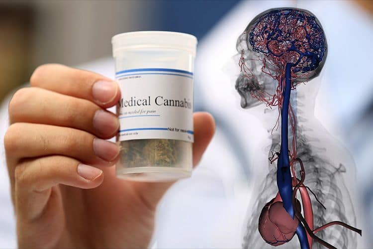 Brain Researchers Say They've Found The First Negative Side Effect Of Cannabis