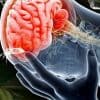 Cannabis for Post-Concussion and Brain Trauma Treatment