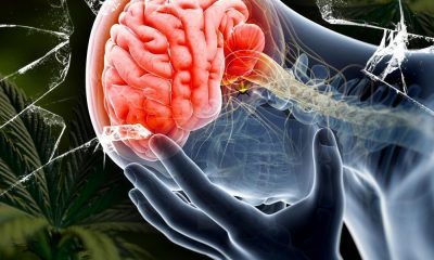 Cannabis for Post-Concussion and Brain Trauma Treatment