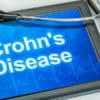 10 Best Cannabis Strains for Crohn's Disease